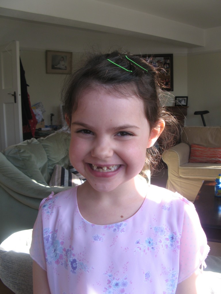 loose tooth