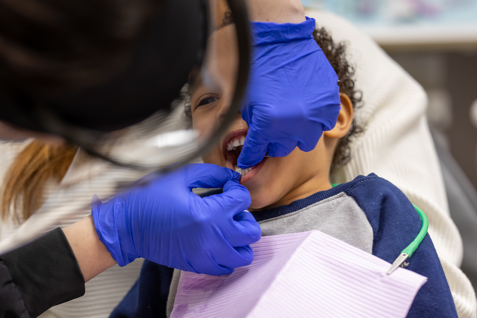 Dental Fillings