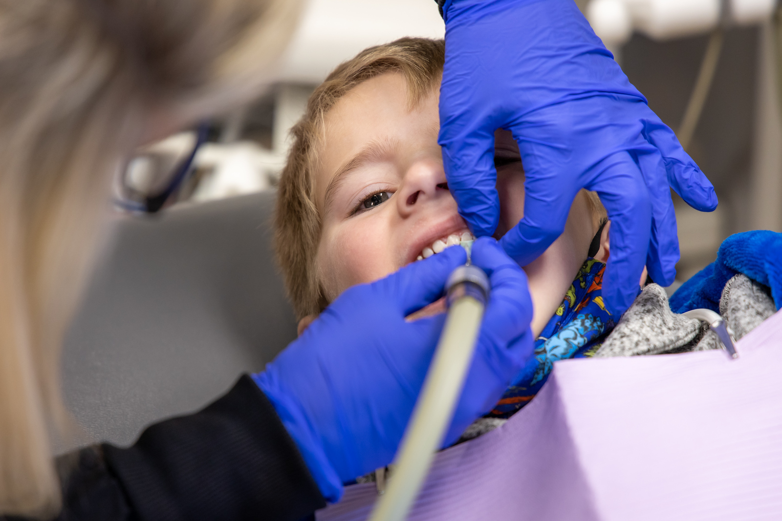Tooth Extractions